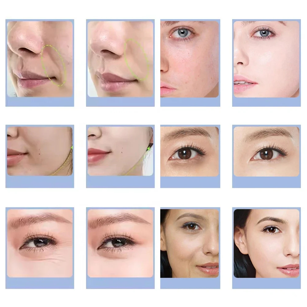 7 種類のフェイシャル CO2 酸素バブルマシン酸素ジェット - Skincare Exfoliating のレビューと価格