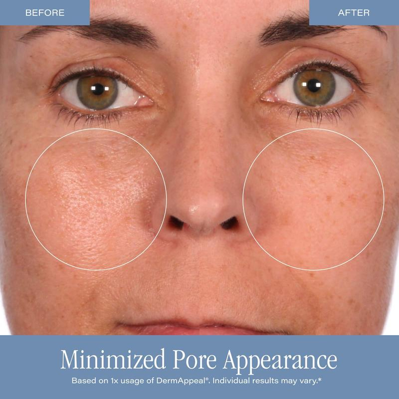 化粧品 DermAppeal マイクロダーマブレーション ビ - Skincare Exfoliating のレビューと価格