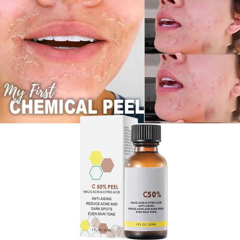リンゴ酸とクエン酸配合のフェイシャルピール40%ピーリングセ - Salicylic Acid Cleanser のレビューと価格